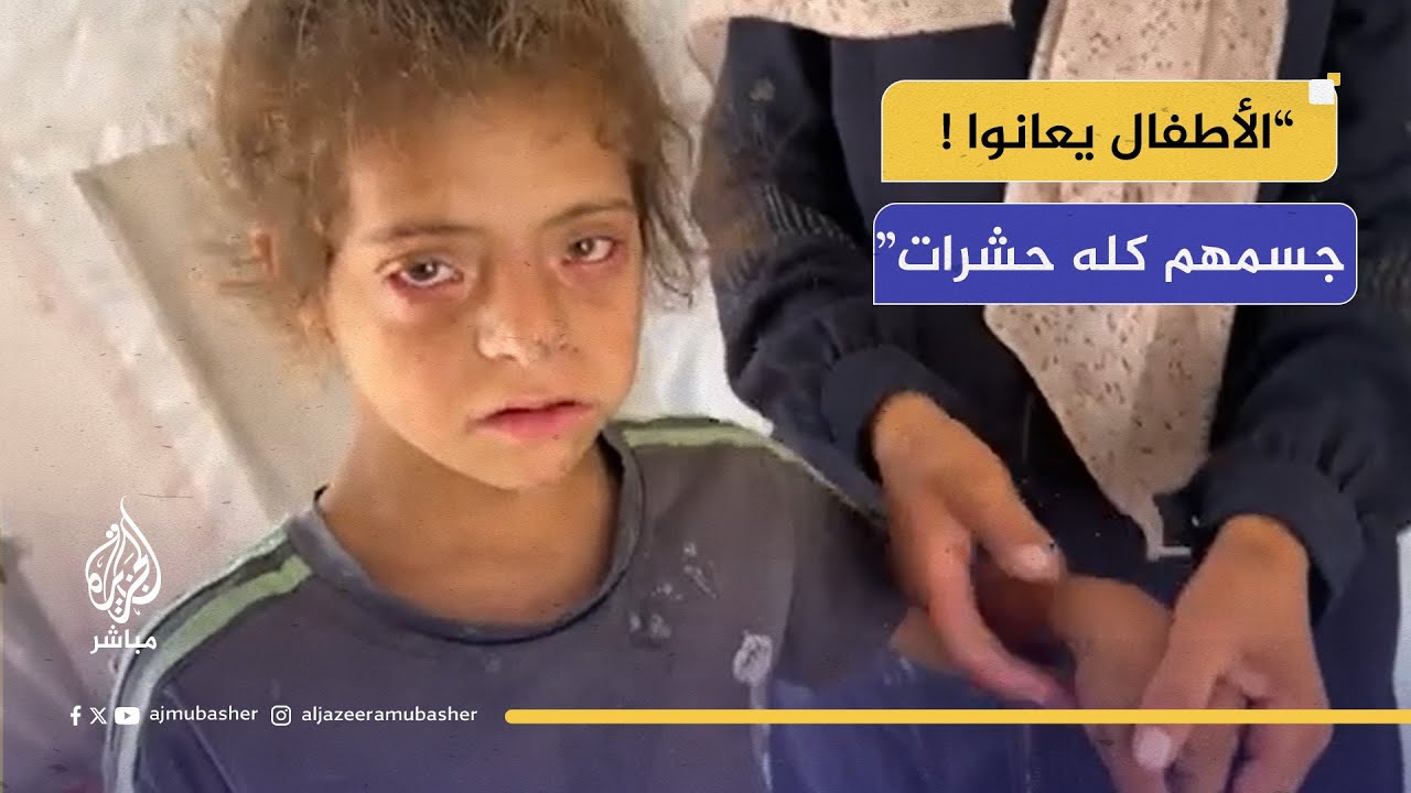 هل يستمر تجاهل معاناة أطفال غزة؟ 