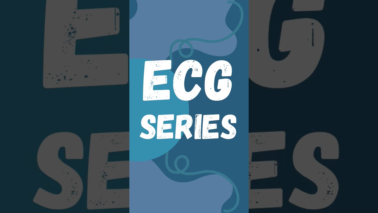 #ecg