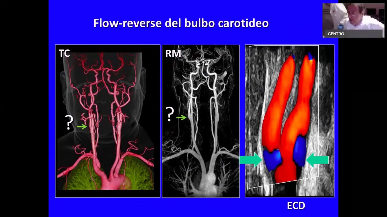 Ultrasound Week School - ECOSU101 lezione 19