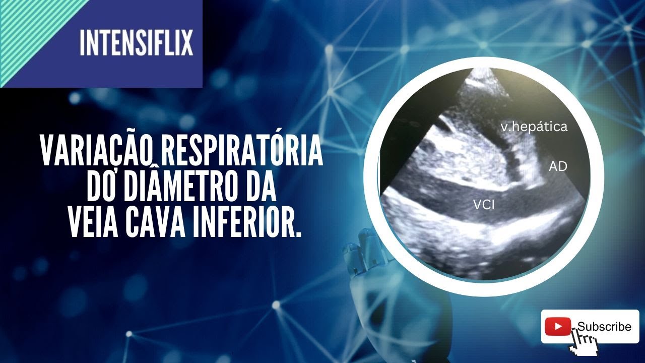 Avaliação de Fluidorresponsividade através da variação do diâmetro da veia cava inferior.