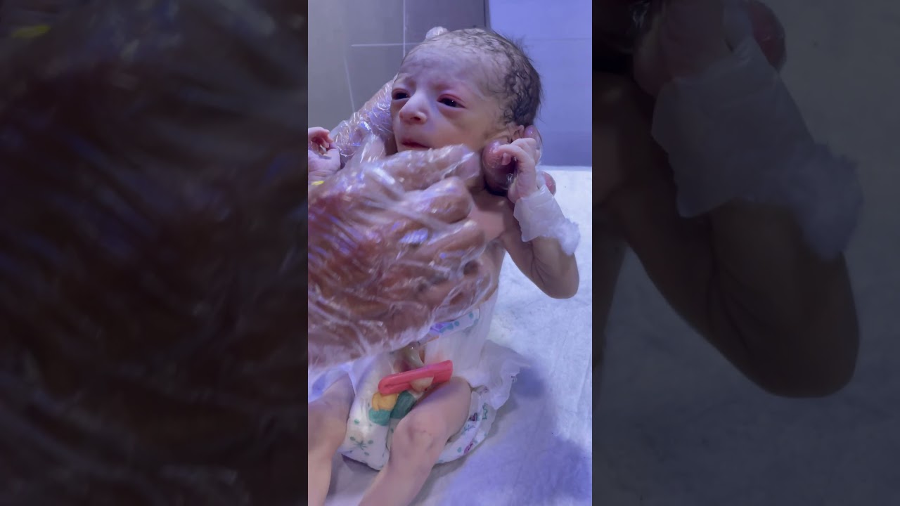 ✨ 1.4kg Miracle Baby: A Tiny Fighter in the NICU! 👶💙 #baby #babyvideos #nicubaby #cutebaby