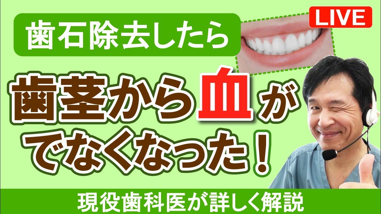 【歯石除去したら、歯茎から血が出なくなった！】
