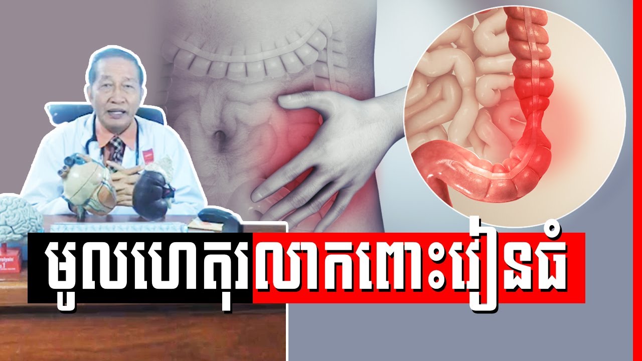 រលាក ពោះវៀនធំ រ៉ាំរ៉ៃ , IBS Irritable Bowel Syndrome Dr.​ Chey Vithia​