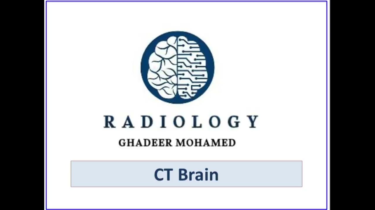 تقنيات الاشعة | المحاضرة 4 | CT Brain (2)