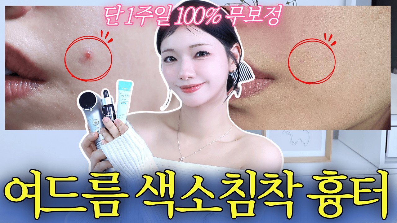 ‼️3개만‼️1주일쓰면100%무조건좋아집니다. 홈케어로 여드름 색소침착 없애는 방법 올리브영ㅣ여드름 자국 없애기, 여드름 흉터,여드름 착색 없애기