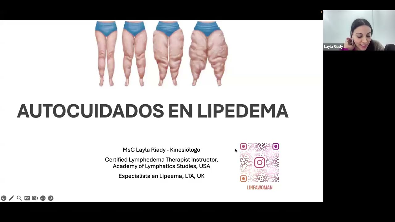Clase Autocuidados en Lipedema de la A a la Z