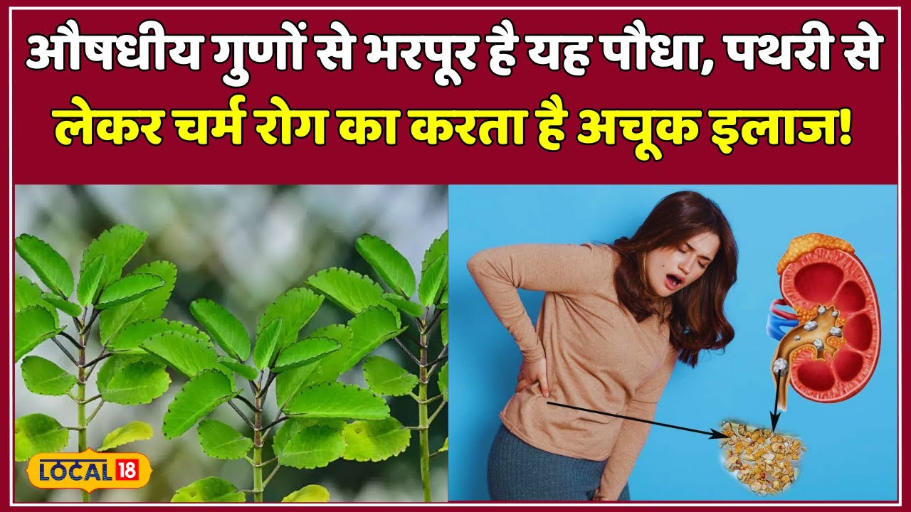 Kidney Stone: पथरी के इलाज के लिए रामबाण है ये पौधा जानें इस्तेमाल! #local18
