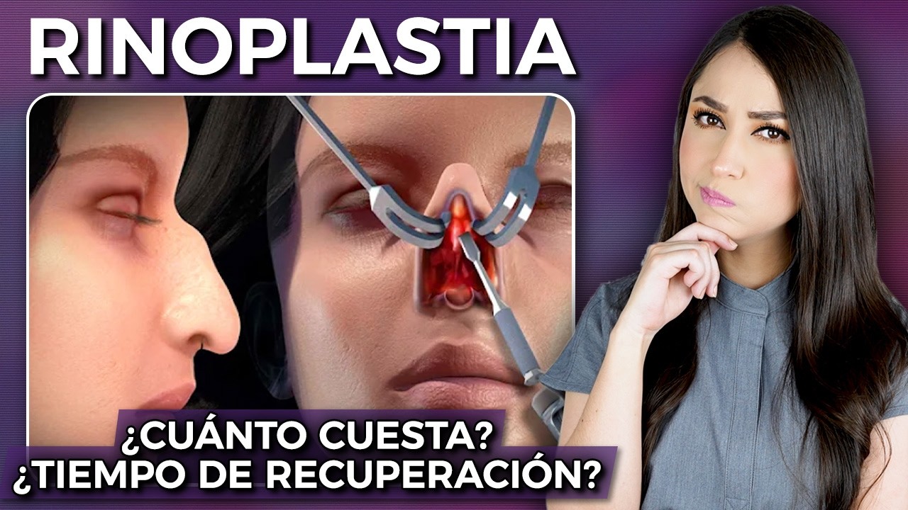RINOPLASTÍA: Cómo se realiza, cuál es el costo, tiempo de recuperación  l Dra. Pau Zúñiga👩🏻‍⚕️