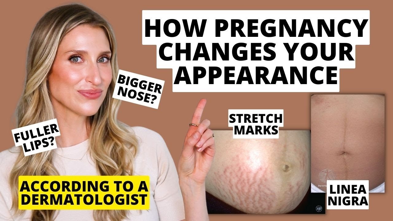 Dermatologist Explains How Pregnancy Changes Your Skin, Hair, & Nails