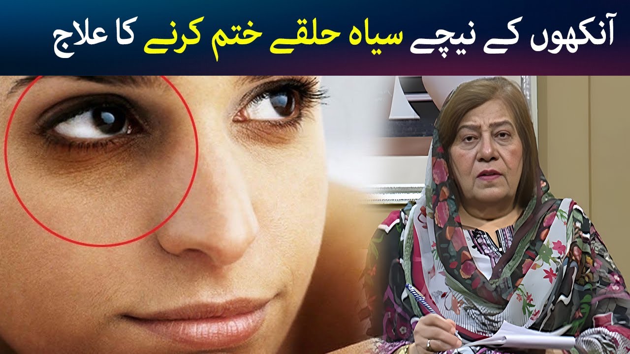 Aankhon ke neeche siyah halqay khatam karne ka ilaj | Dark Circles | Hashmat Bibi  |Avt Khyber