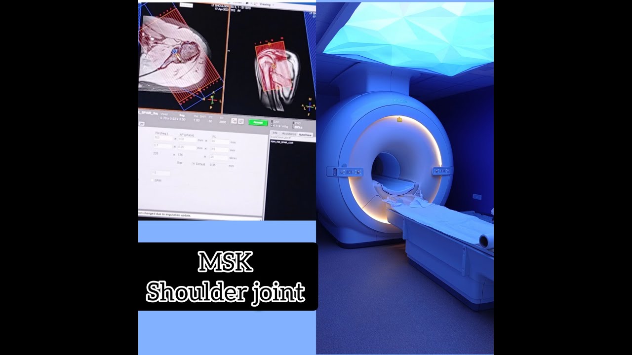MRI Shoulder joint planning & Positioning on #philips 3T #mri