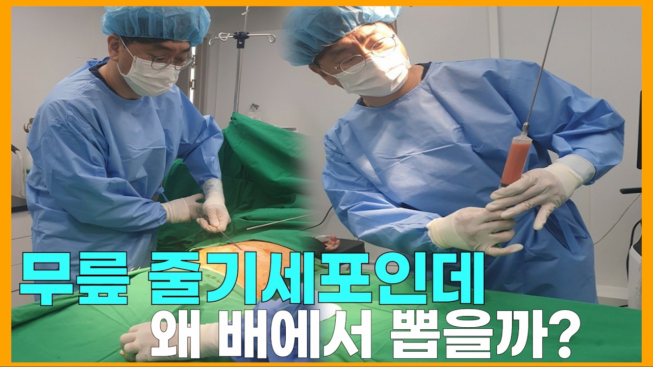 줄기세포 지방에서 뽑는 이유?