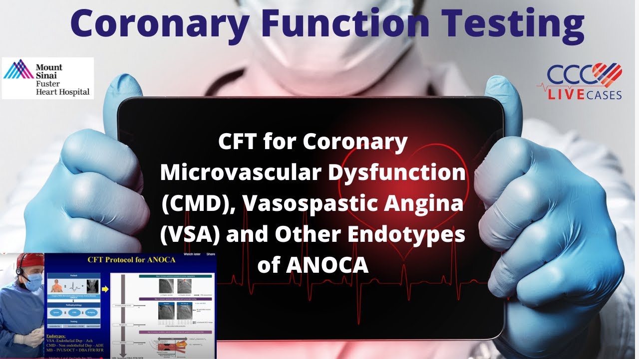 CFT for Coronary Microvascular Dysfunction(CMD), Vasospastic Angina(VSA)and Other Endotypes of ANOCA