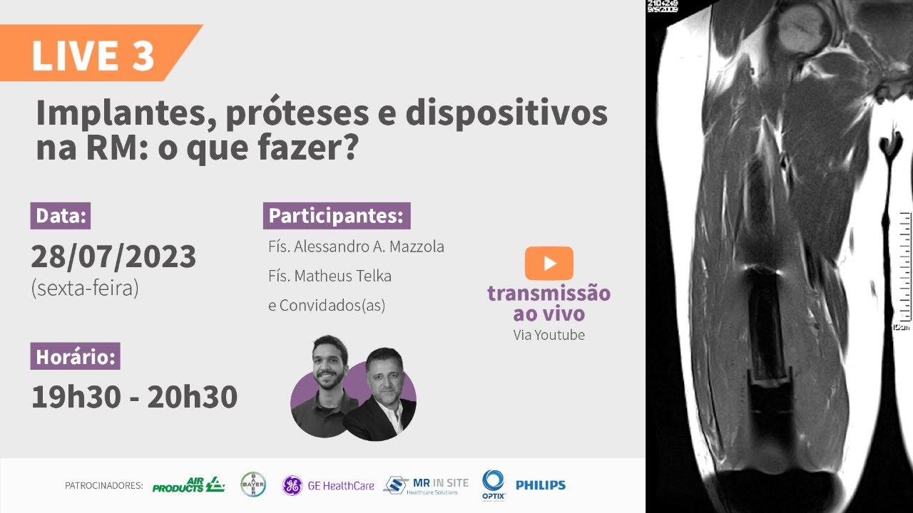 Implantes, próteses e dispositivos na RM: o que fazer?