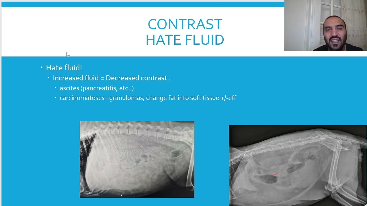 Chapter 6 Radiology: Let's study X rays #4.  Principles DR, Opacity, Contrast
