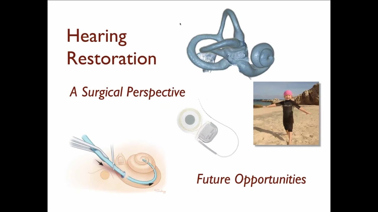 Latest Updates on Cochlear Implant Technology  Dr  Blevins