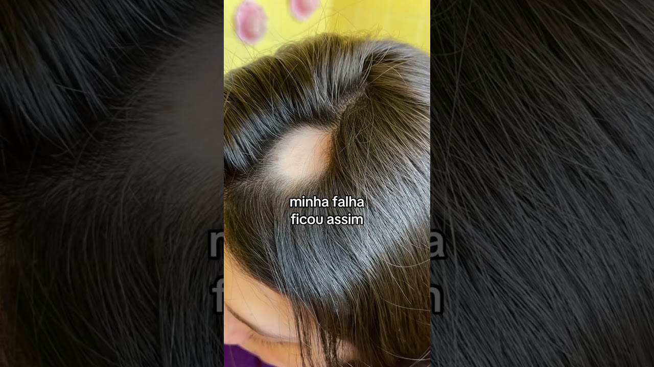 O t&ocirc;nico poderoso &eacute; tudo! 🧡 #tonicocapilar #tonicopoderoso #crescimentocapilar #crescercabelo