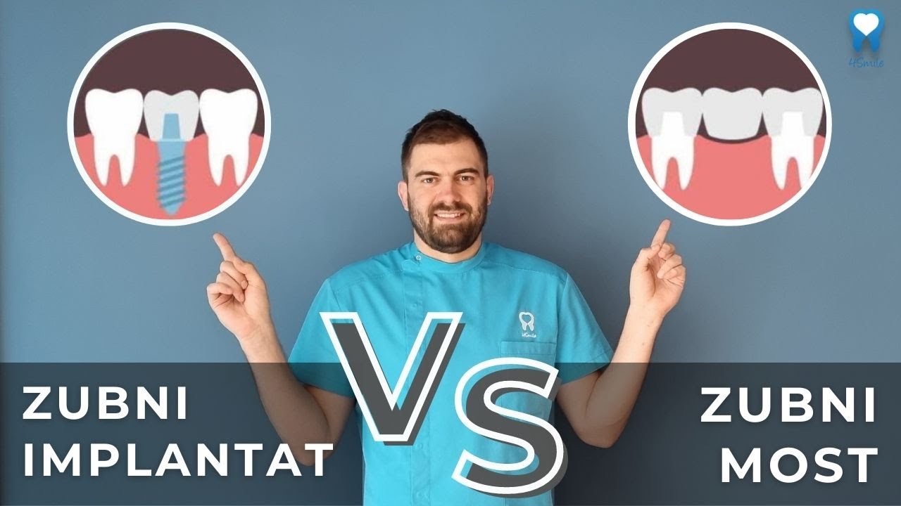 VIDEO BLOG - ZUBNI IMPLANTAT VS. ZUBNI MOST