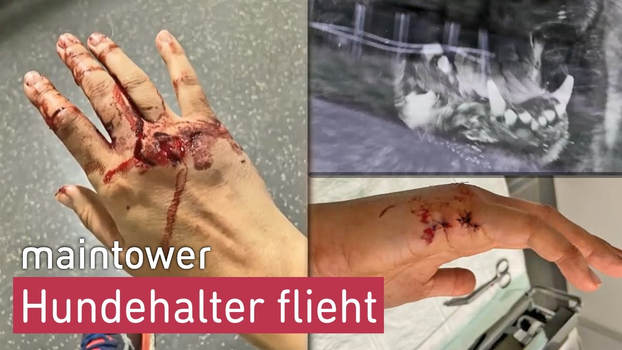 Hund verletzt Julia schwer – Hundebesitzer haut einfach ab | maintower