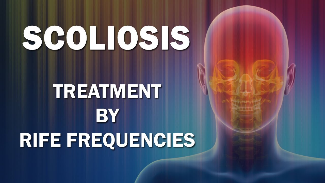 Scoliosis - RIFE Frequencies Treatment - Energy & Quantum Medicine with Bioresonance