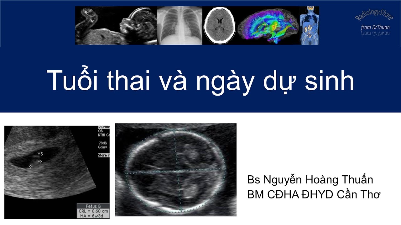 Tuổi thai và ngày dự sinh