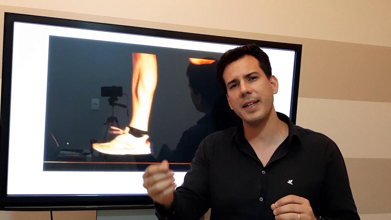 Caso clínico Joelho