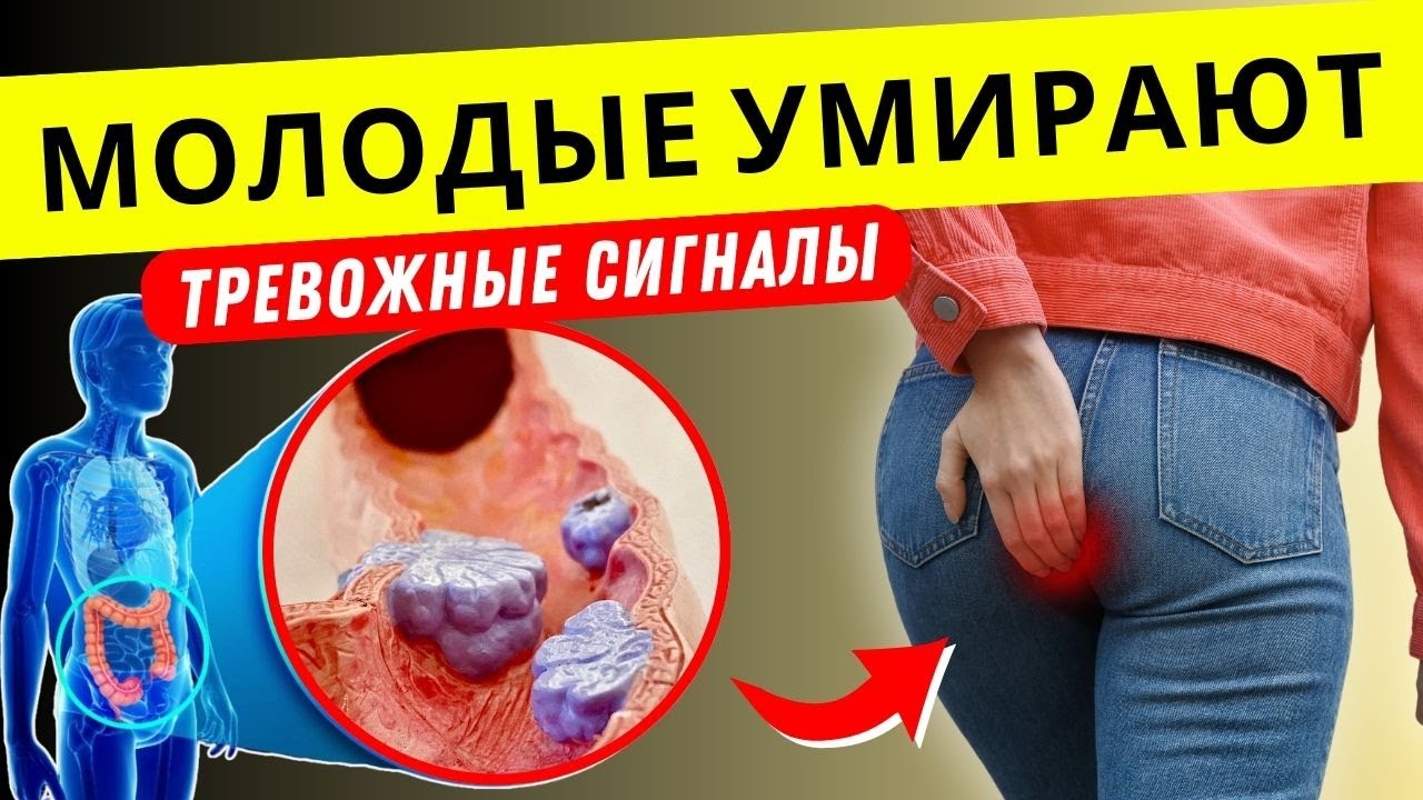 Рак кишечника среди молодых растёт — эти симптомы нельзя игнорировать