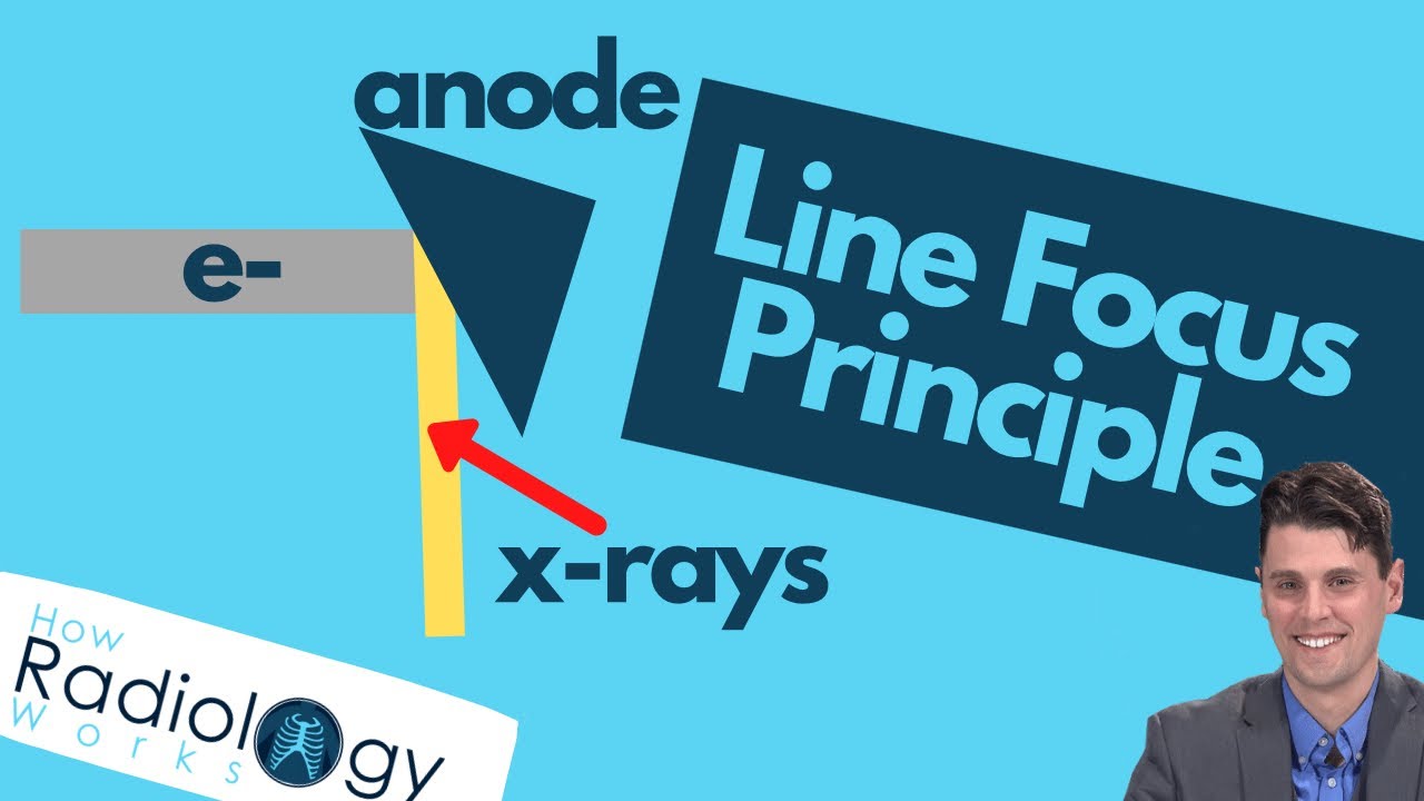 X-ray Line Focus Principle (Rad Tech Guide)