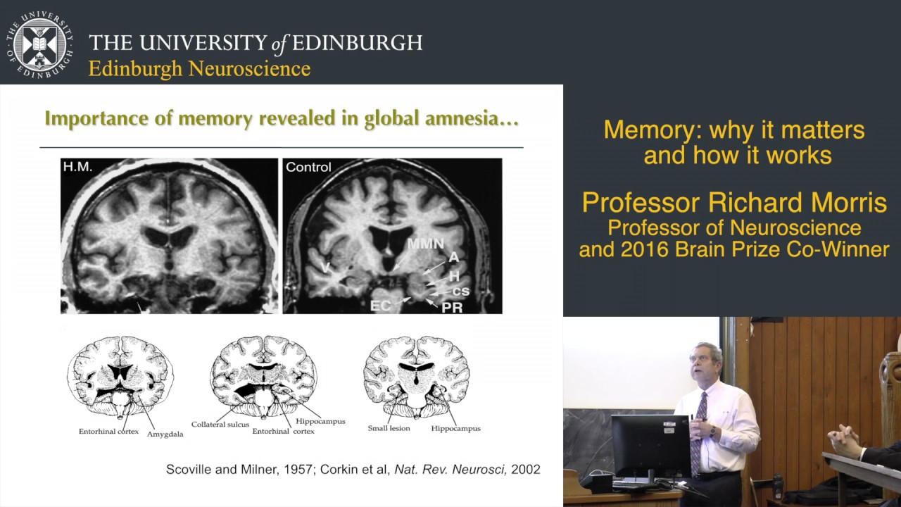 Memory: why it matters and how it works