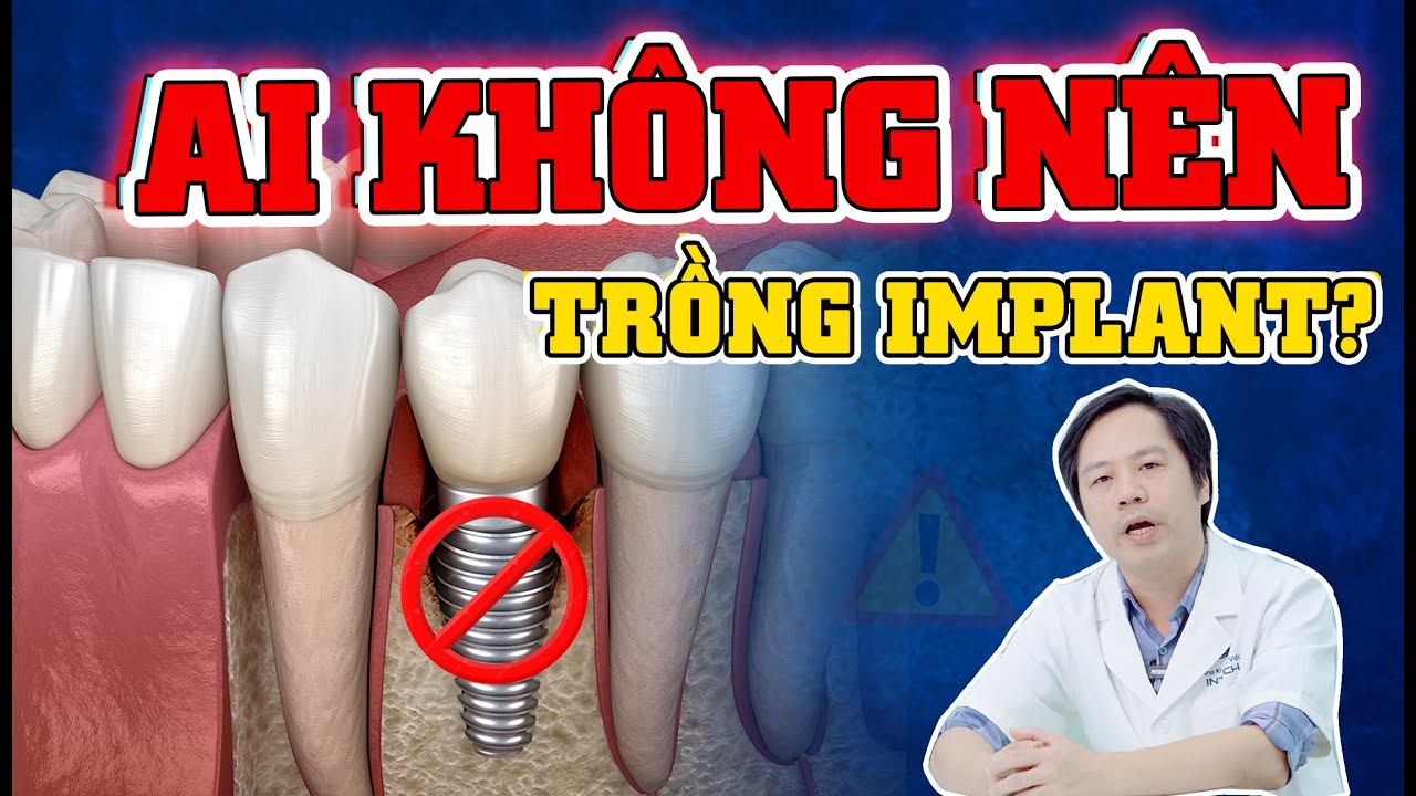 4 Trường Hợp TUYỆT ĐỐI Không Được Cấy Ghép Implant.