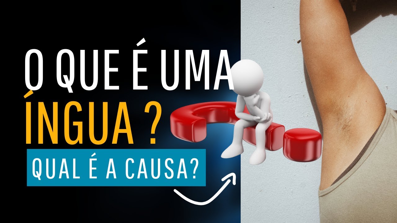 Dicas de Saúde Dr Marcelo Sandrín: O que é uma Íngua?