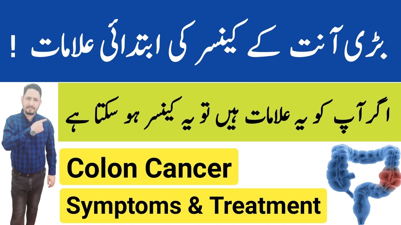 Colon Cancer Symptoms & Treatment In Urdu Hindi - Irfan Azeem