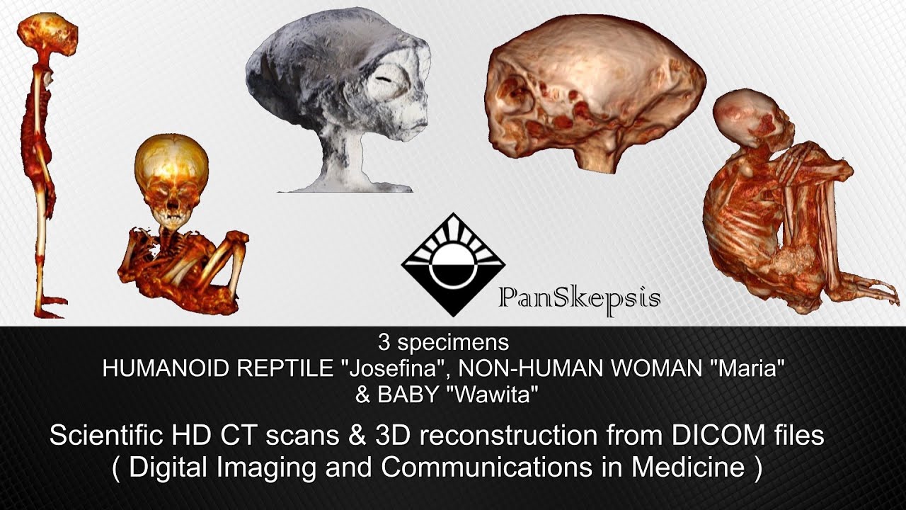 Nazca Alien Mummies - HD CT Scans of Josefina (Humanoid Reptile), Maria (Jamin Palpanensis) & Wawita