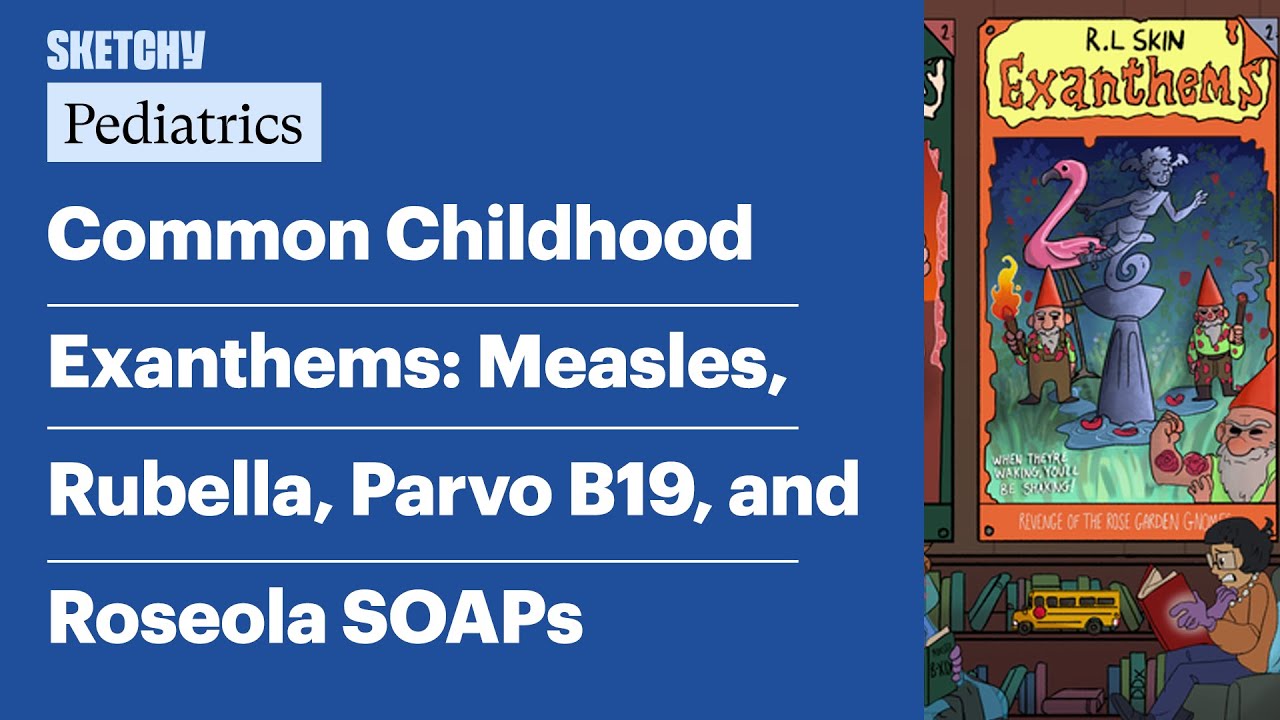 Common Childhood Exanthems: Measles, Rubella, Parvo B19, and Roseola SOAPs (Pediatrics) | Sketchy