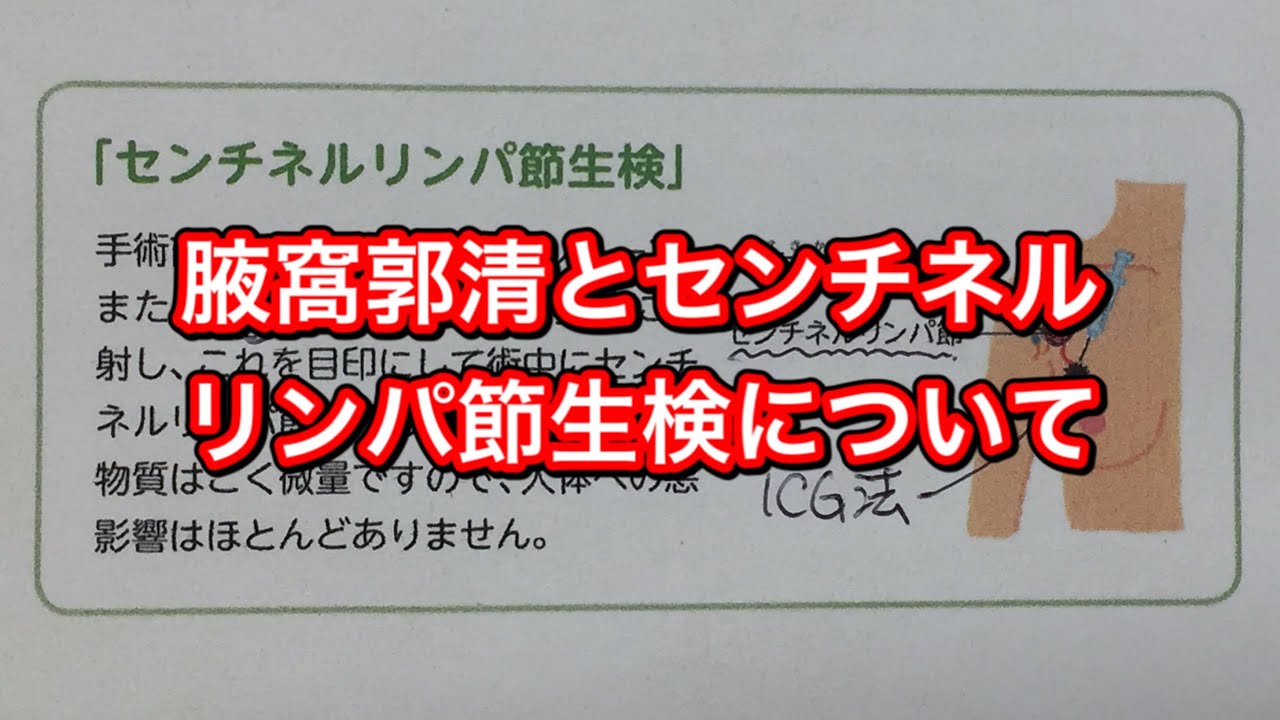 腋窩郭清とセンチネルリンパ節生検について