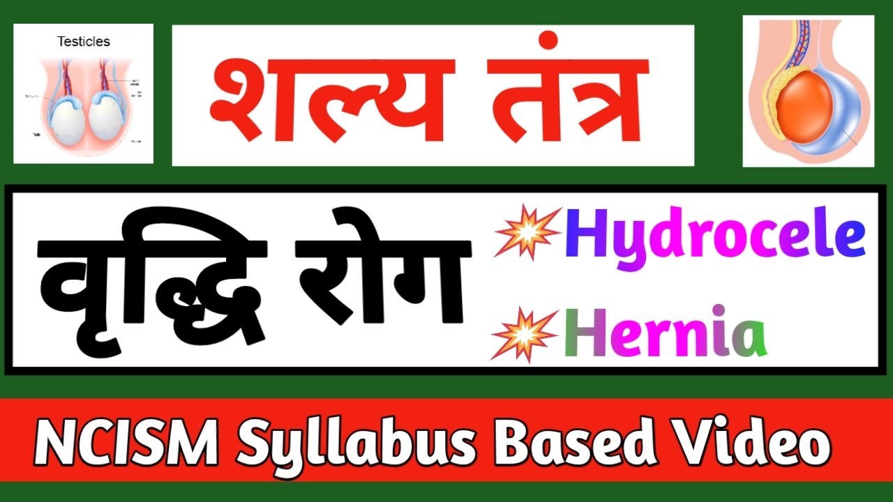 Vriddhi Roga Shalya Tantra | वृद्धि रोग । शल्य तंत्र | Shalya Tantra | Vriddhi Roga | BAMS | NCISM .