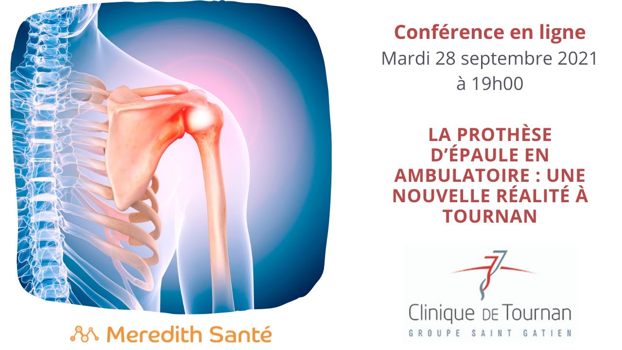 La prothèse d’épaule en ambulatoire : une nouvelle réalité à Tournan