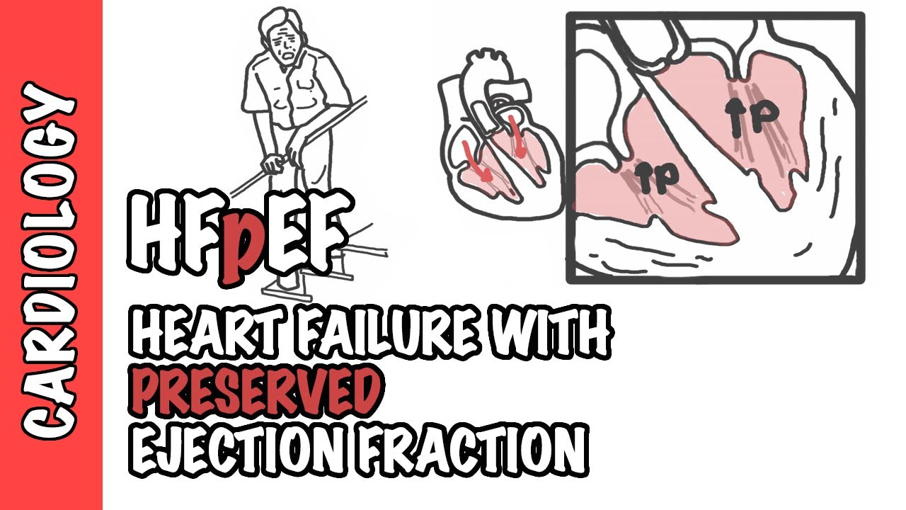 HFpEF — сердечная недостаточность с сохраненной фракцией выброса
