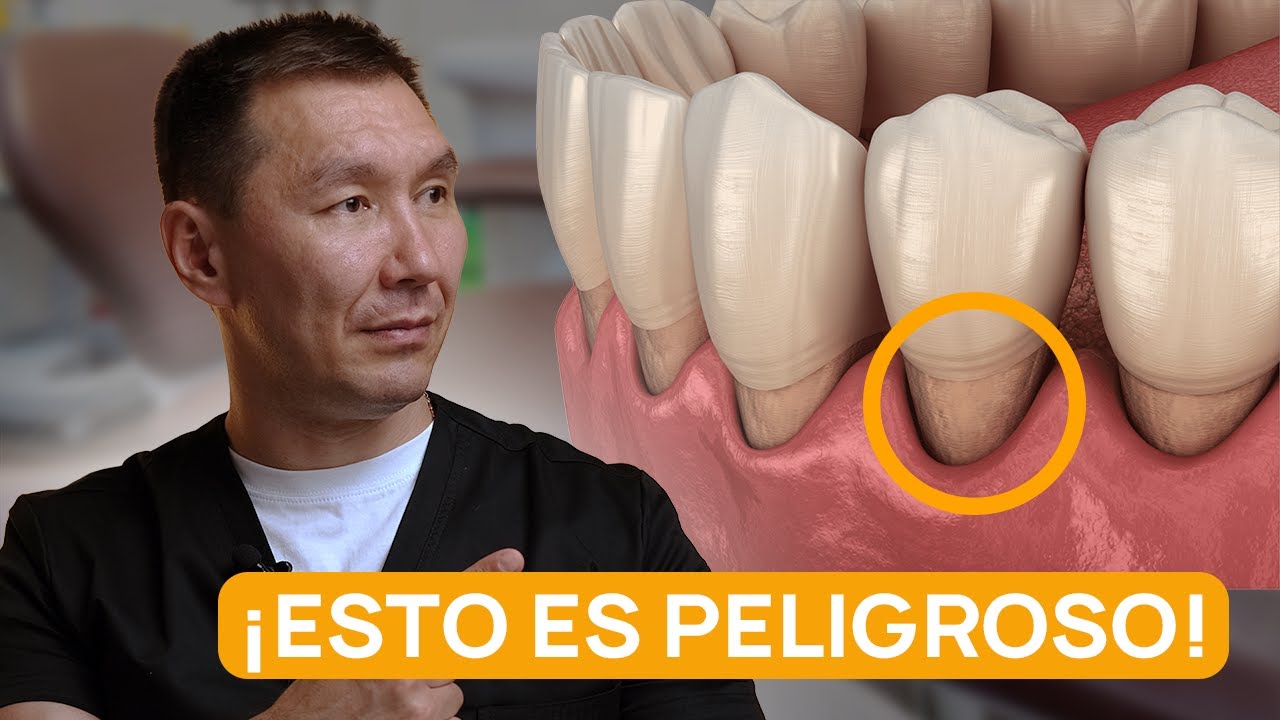 ¿Están expuestas las raíces de tus dientes? ¡Esto es lo que hay que hacer durante una recesión!