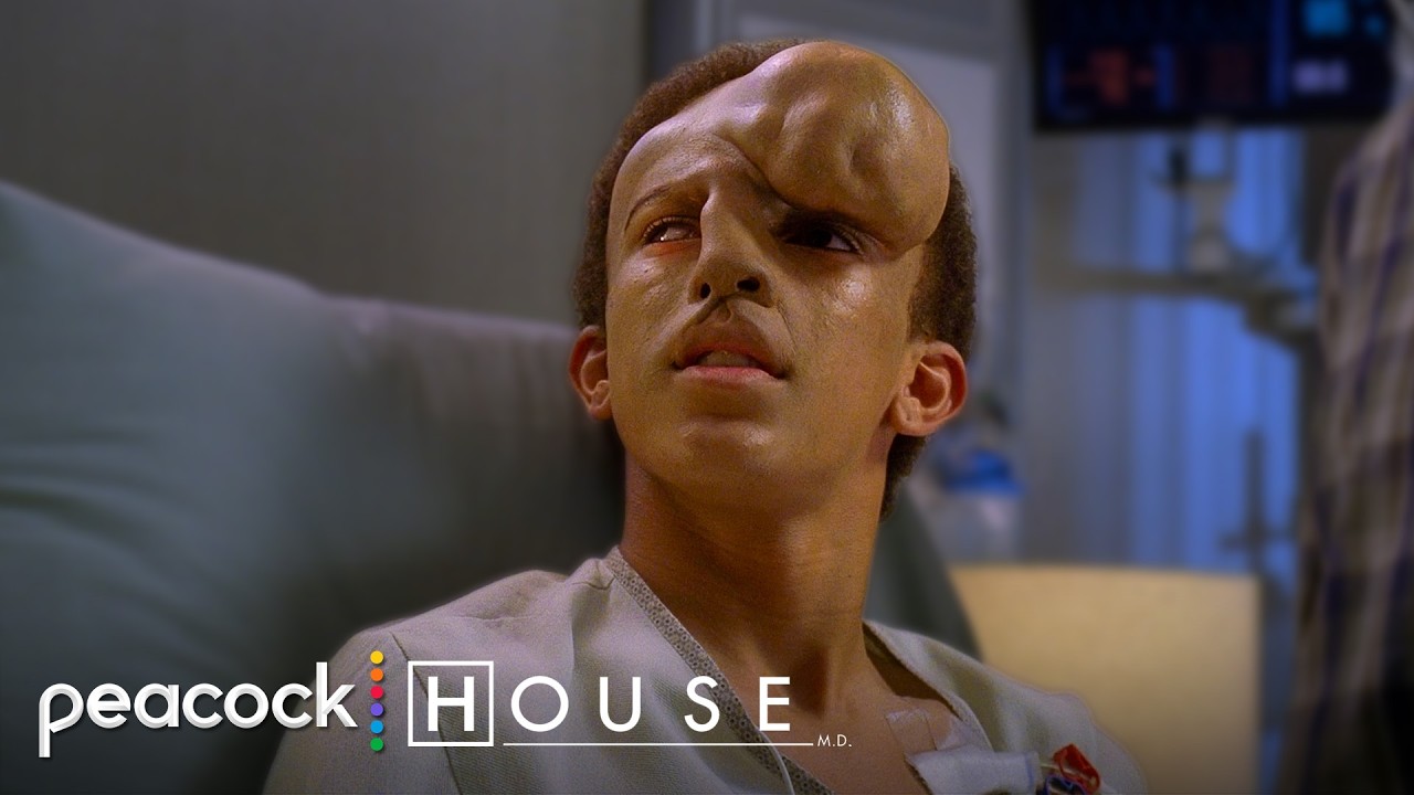 Heart Attack Stops Life Changing Facial Reconstruction Surgery | House M.D.