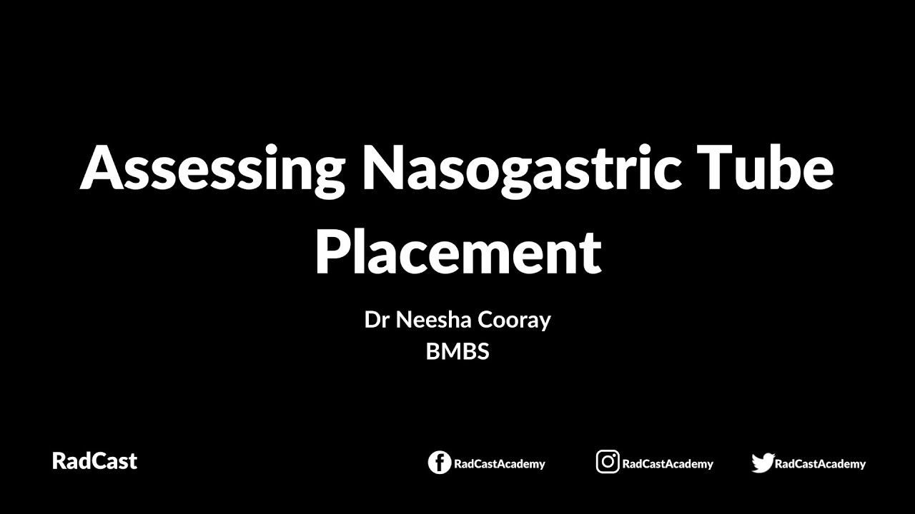Assessing Nasogastric Tube Placement - By Dr Neesha Cooray #radiology #rcanti #meded #doctor