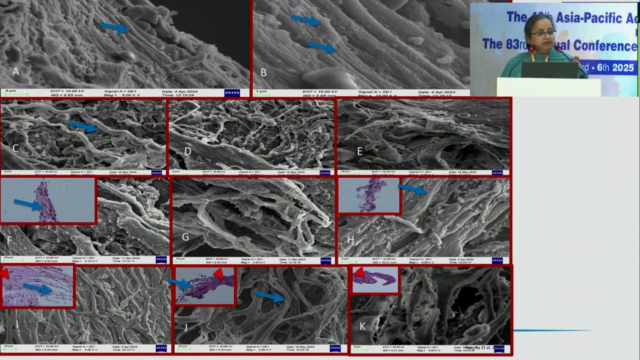 AIOS2025 GP148 T Dr  Aparna RAO Anatomy and Physiology of Outflow Pathway