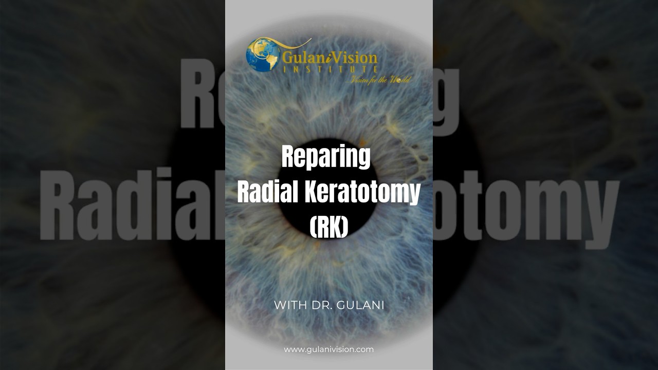 Repairing Radial Keratotomy (RK): @GulaniVision