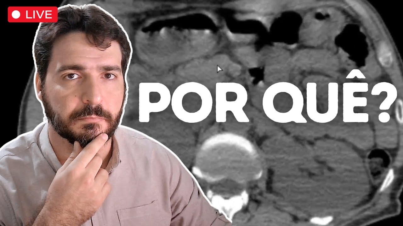 Vítima de ACIDENTE DE CARRO com uma dor abdominal muito estranha. Por quê? | TOMOGRAFIAS Ep. 1.