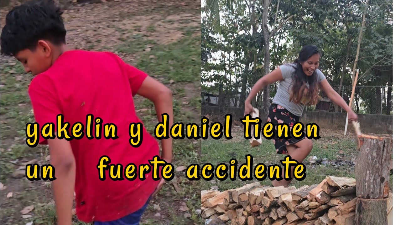 En este video paso de todo yakelin tiene un accidente y casi se quiebra el pie 😱😱