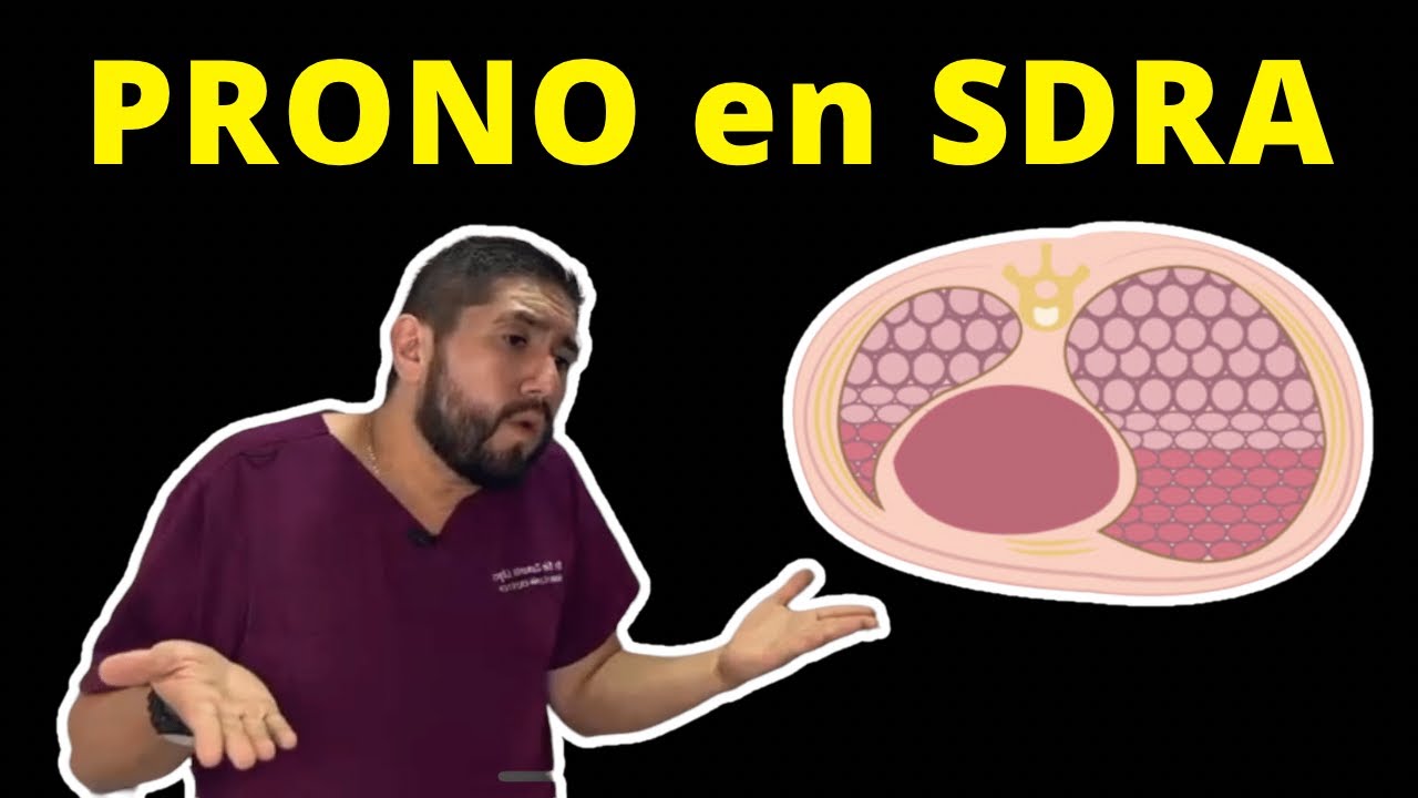 PRONO en SDRA 🫁🌬️By Dr. Zamarrón