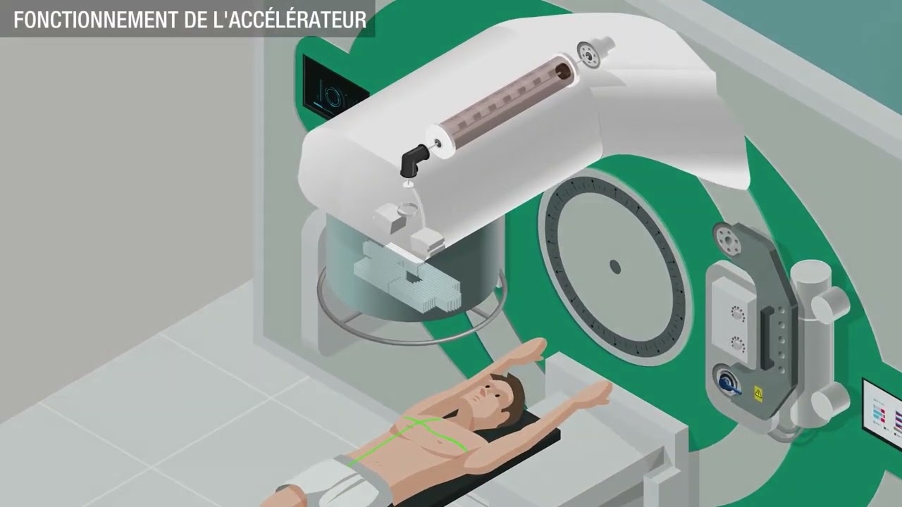 [Comment ça marche ?] La radiothérapie