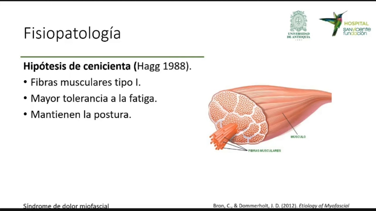 Sindrome de dolor miofascial. Dr. Hernan Henao