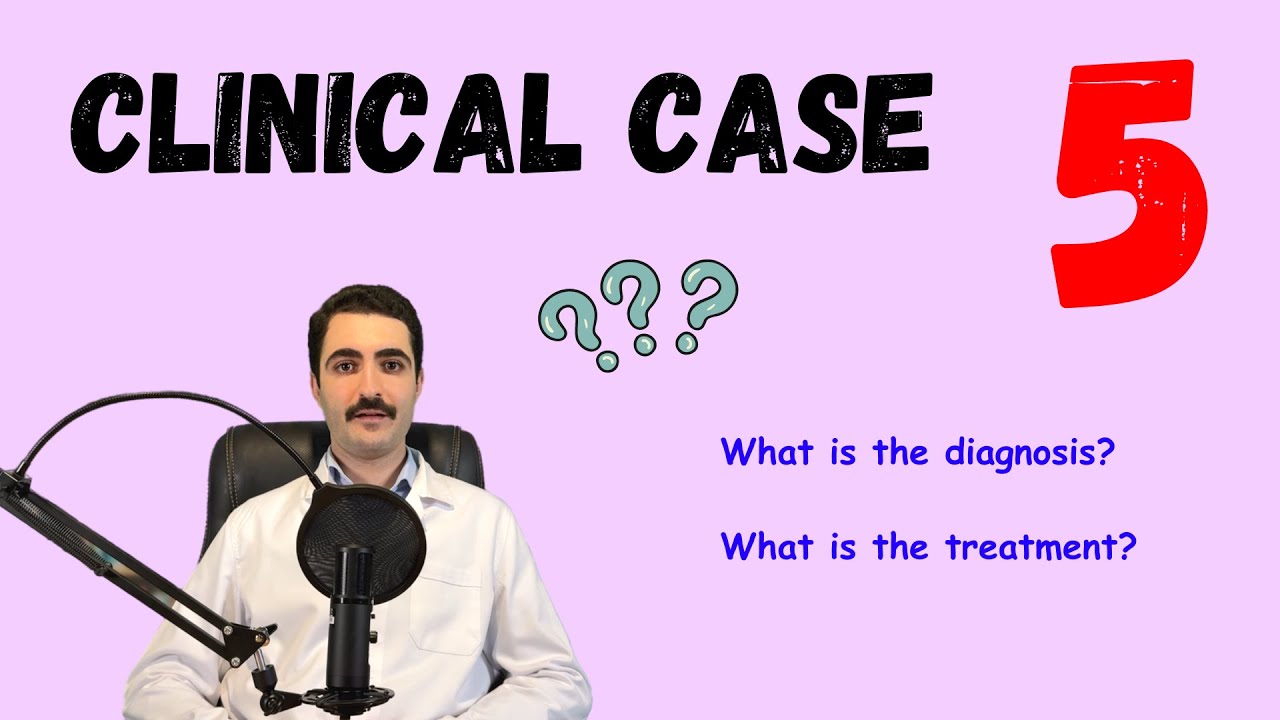 How do you manage this case? - Clinical case simulation