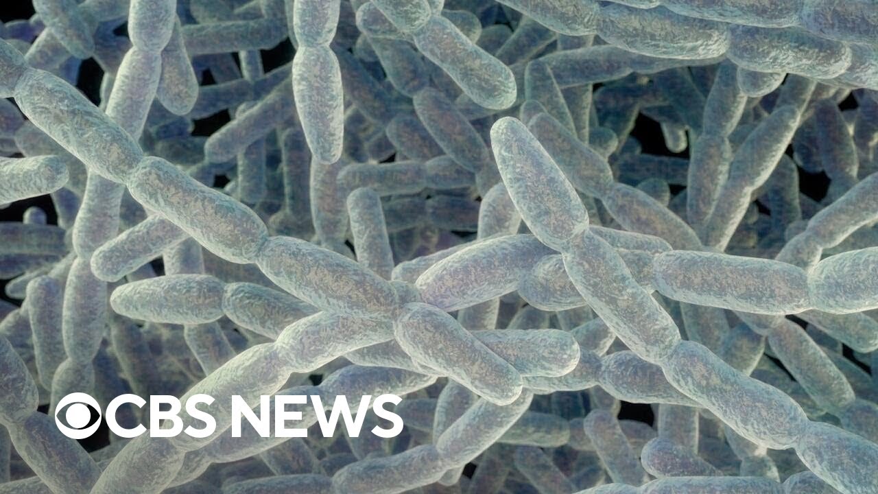 What to know about Legionnaires' disease breakouts in New York, Michigan